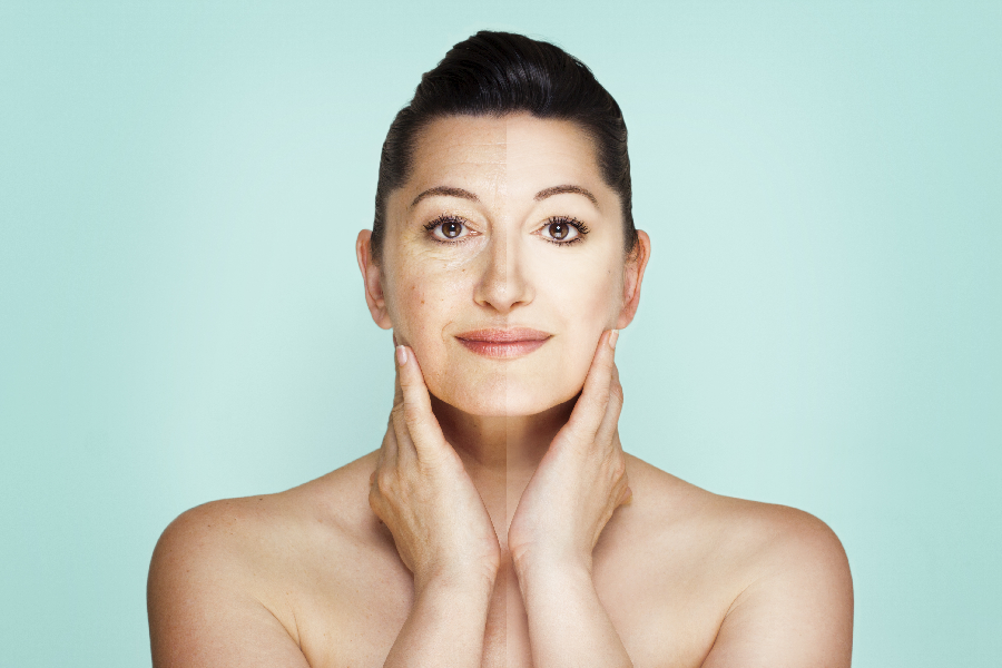 Neck Lift Procedure – Definition, Preparation, Steps, And Recovery