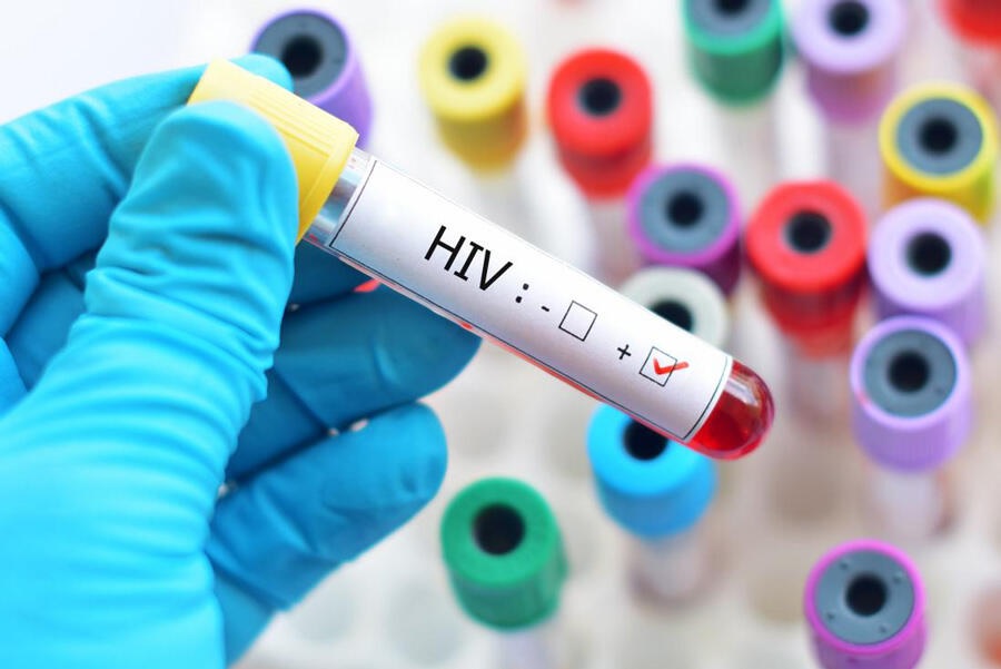 HIV Test Choices: What You Need Now