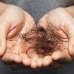 Essential Tips to Avoid Hair Loss Post-Bariatric Surgery