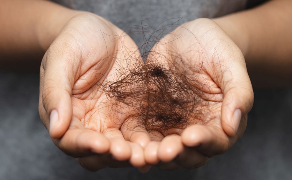 Essential Tips to Avoid Hair Loss Post-Bariatric Surgery