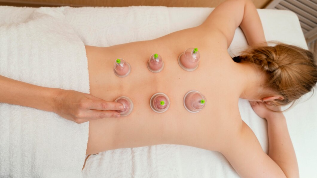 Cupping Massage Therapy: Techniques and Application in Modern Healthcare