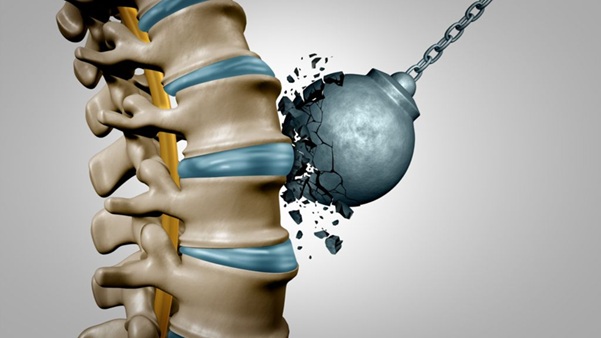 The Complete Guide to Spinal Surgery: Procedures, Risks, and Benefits