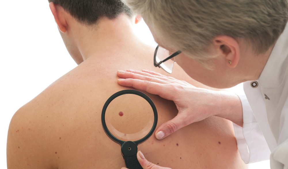 Understanding How Dermatologists Diagnose Skin Cancer Understanding How Dermatologists Diagnose Skin Cancer